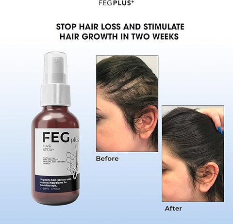 FEGPLUS 2PCS Hair Growth Serum with Gift Eyecream | Seaweed Rosemary Extract, Minoxidil 5% For Hair Oil Regrowth Treatment, Hair Loss Control | Hair Growth Spray Serum For Men Women (50ml)